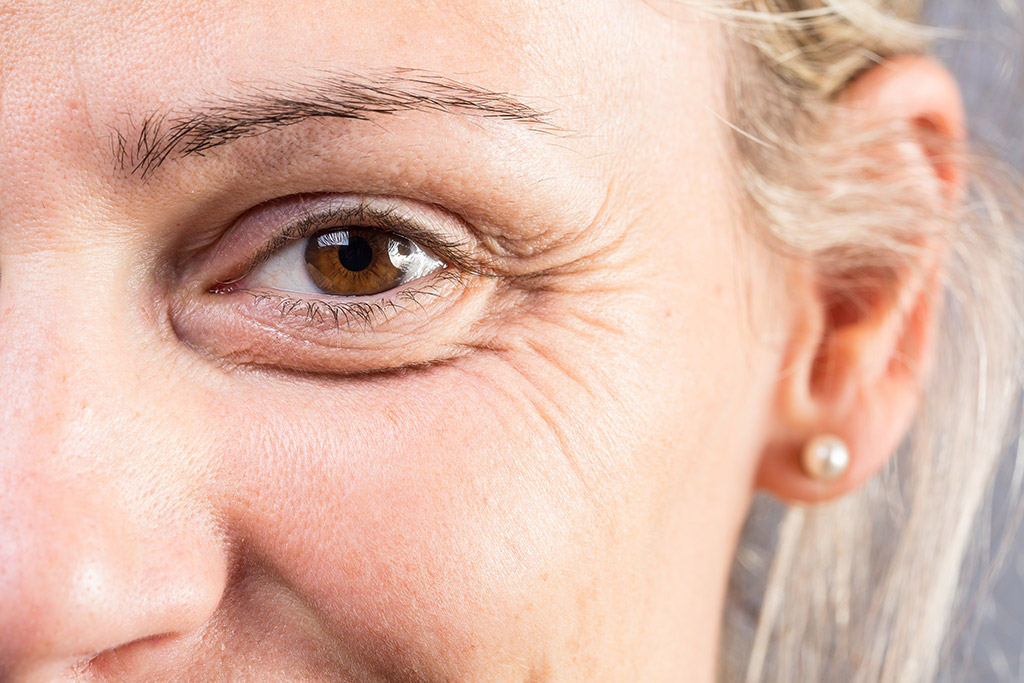 Reduce-Wrinkles-with-these-Amazing-Tips-by-Compassion-Dermatology-in-Alliance,-TX