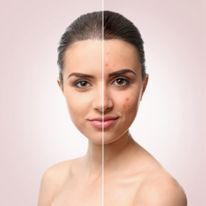 Signs-that-Indicate-You-Should-Visit-Your-Dermatologist-in-Southlake,-TX-Right-Away