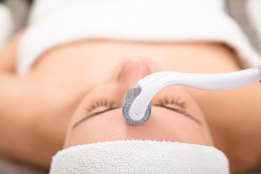 6-Reasons-Why-You-Should-Get-Microneedling-From-Your-Dermatologist-in-Southlake,-TX